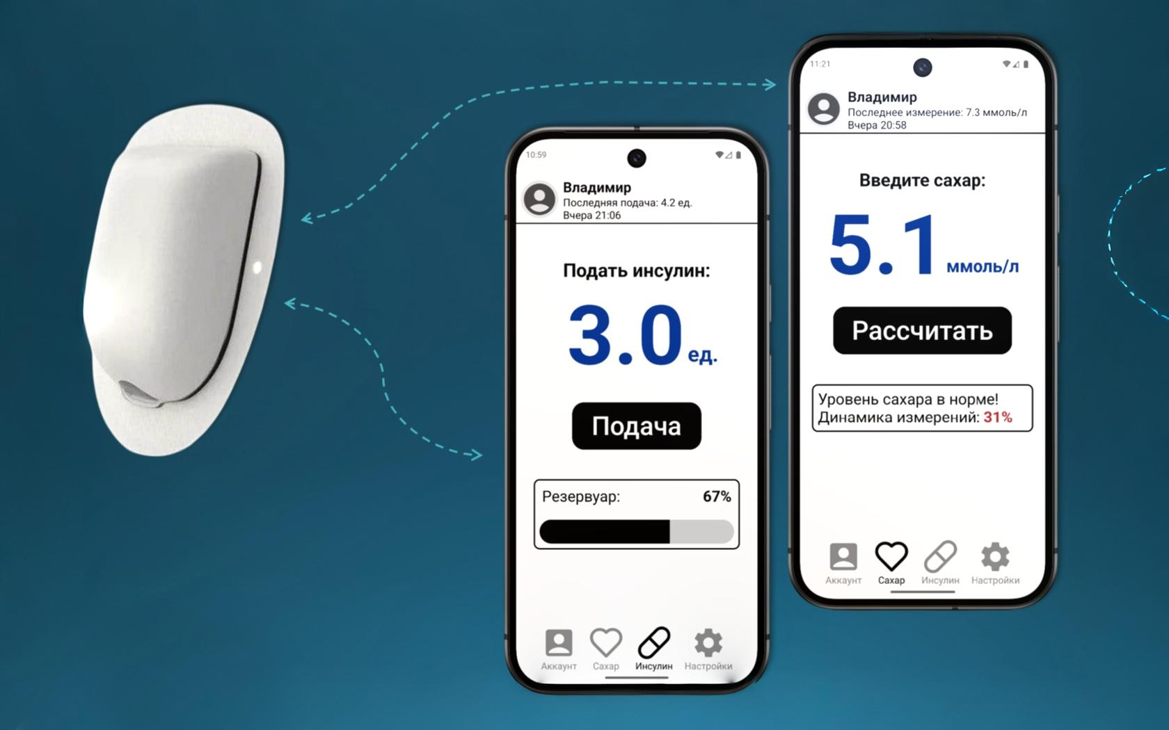 Студент МАИ участвует в создании инсулиновой помпы с полным управлением со смартфона