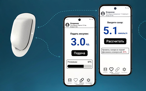 Студент МАИ участвует в создании инсулиновой помпы с полным управлением со смартфона